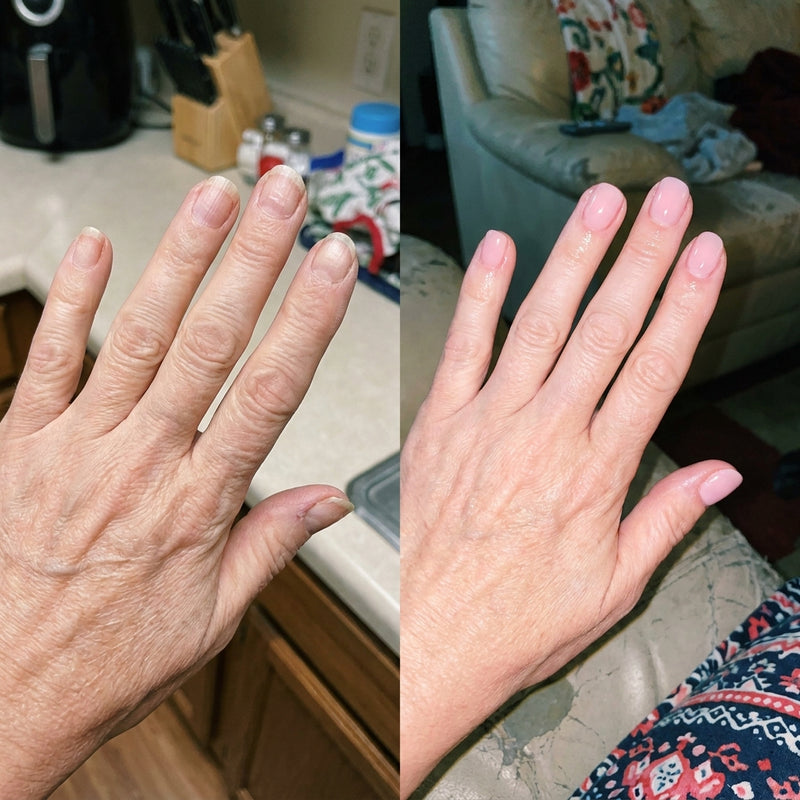 Before and after