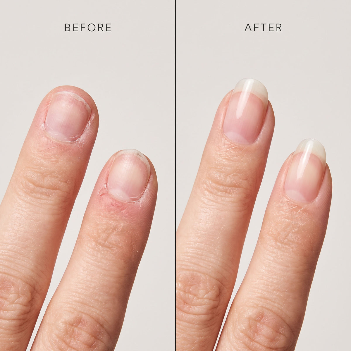 Your natural nails can finally grow back
