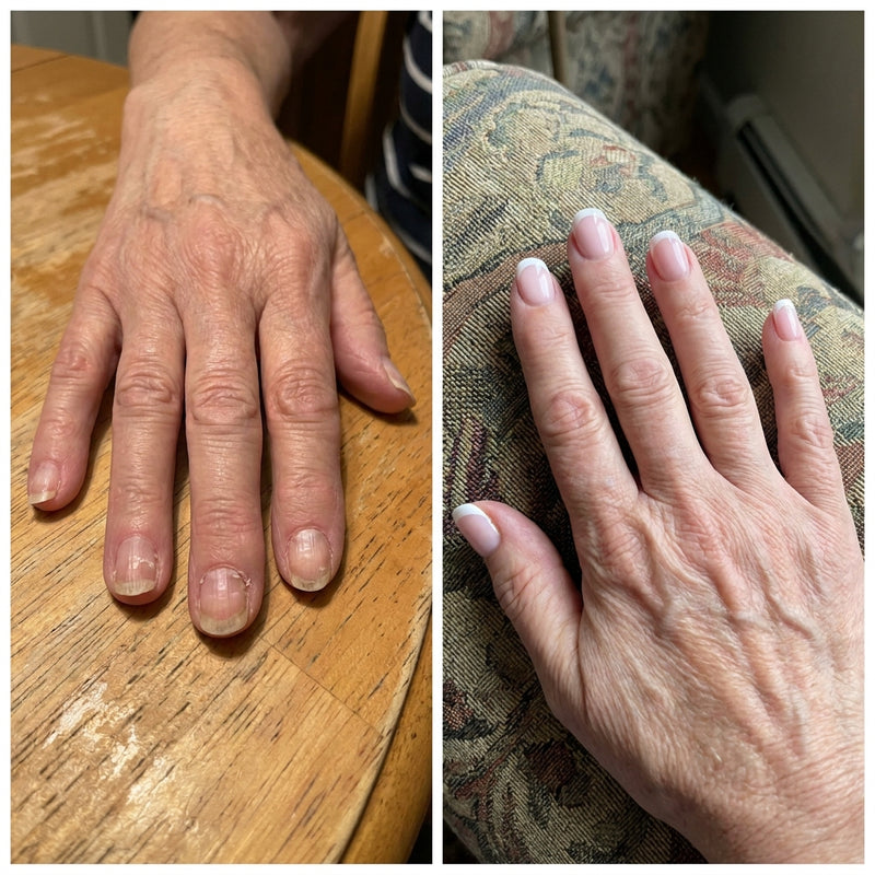 Before and after